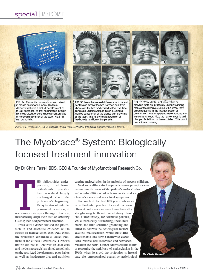 The Myobrace System Biologically focused treatment innovation