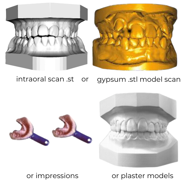 scan or impressions or plaster models